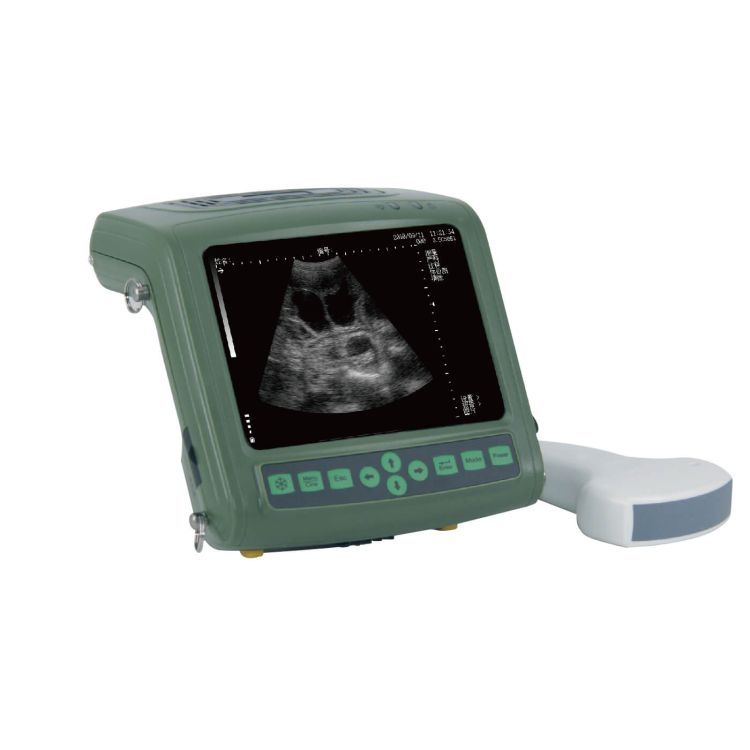 ES8 超音波測孕器