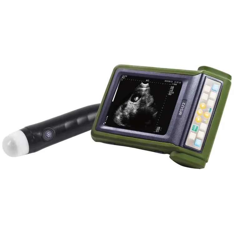 MSU2 超音波測孕器